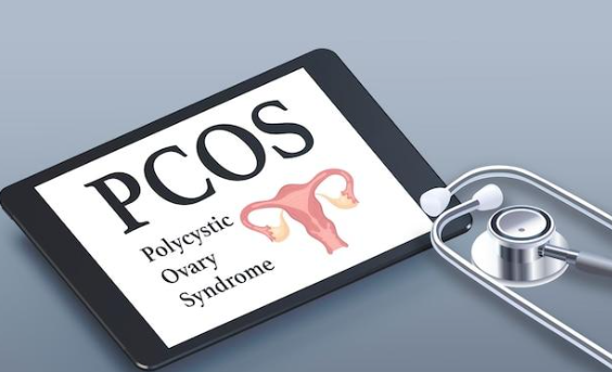 What is Poly Cystic Ovarian Syndrome (or PCOS)?